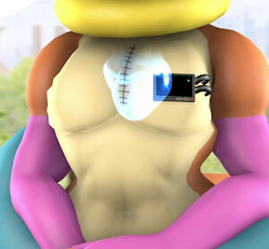 Mechanical Joy (X-ray) by theHappyHeartMan