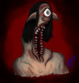 Suicide Worm