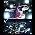 Before and After