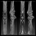 Statue tips by Raysh