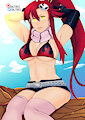 Yoko Littner