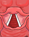 Vocal Cords