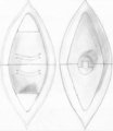 Warshield Front and Back