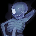 Goretober 2024 : day 08 - Xray