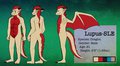 Lupus-SLE, The Reference Sheet! by LupusSLE