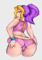 The Human Hedgie by TheAmariaShadow