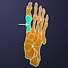 Tarsal